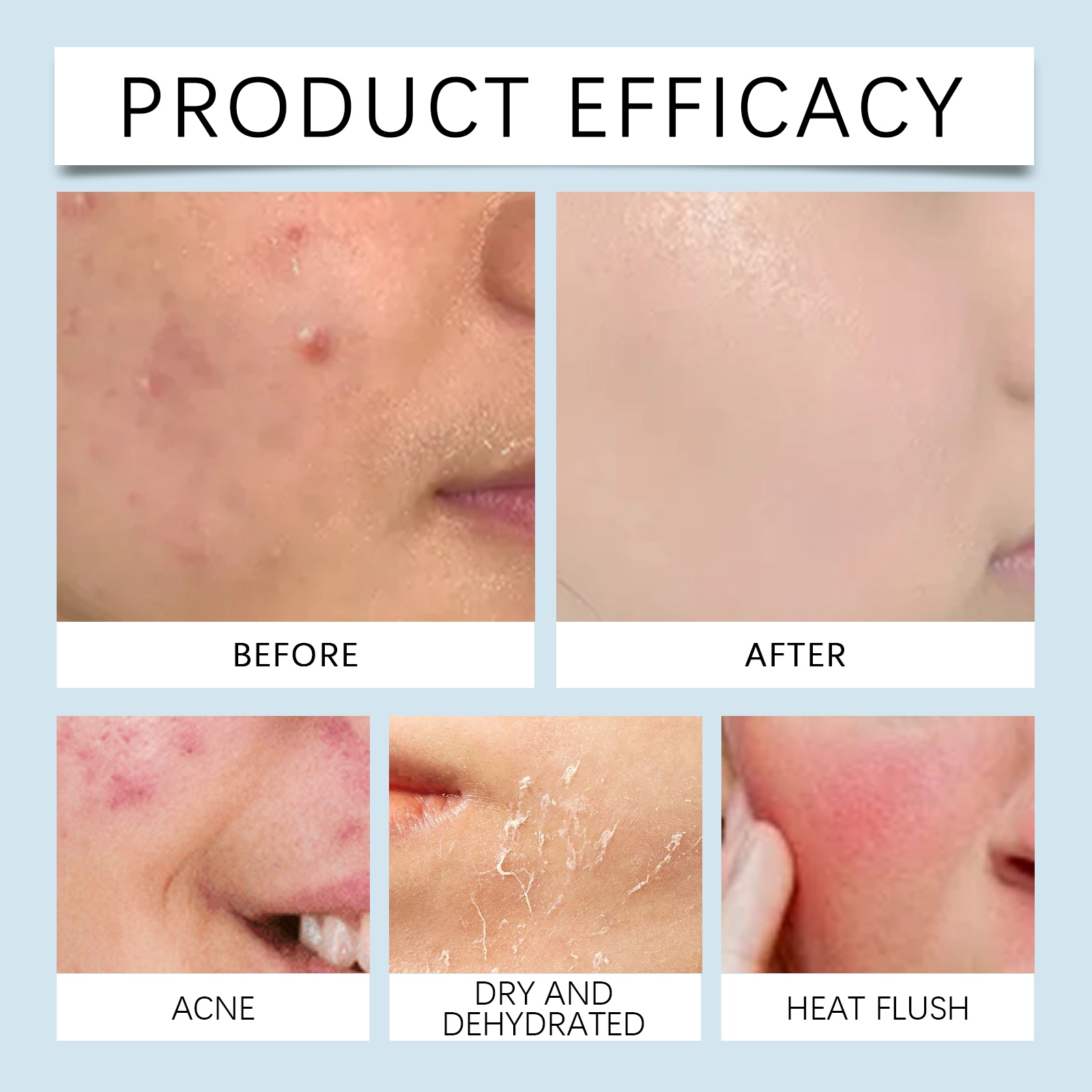 Hydrating roller Serum 0.25mm  - Luxury Skincare Serum incelemesi ve fiyatı